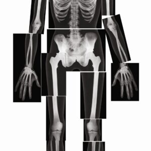 Levensgrote röntgenfotos van een jongvolwassene, tonen 18 skeletdetails voor educatief gebruik.